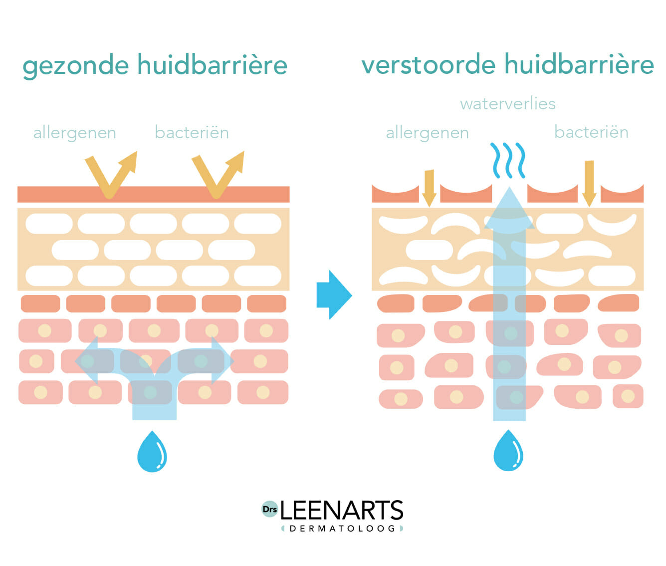 Niacinamide, een parel van een ingrediënt Drs Leenarts Dermatoloog