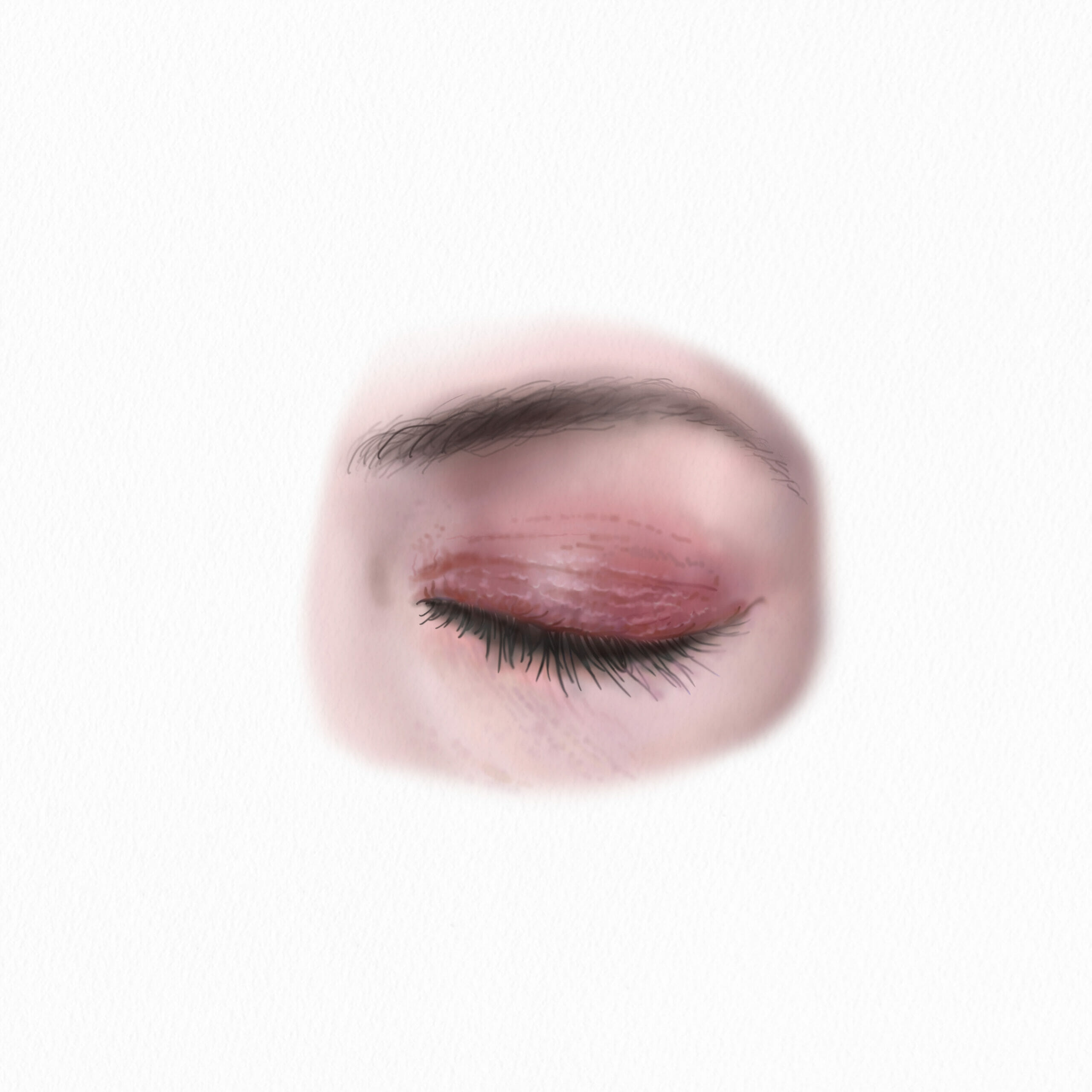 Huidallergie Wat Te Doen Drs Leenarts Dermatoloog