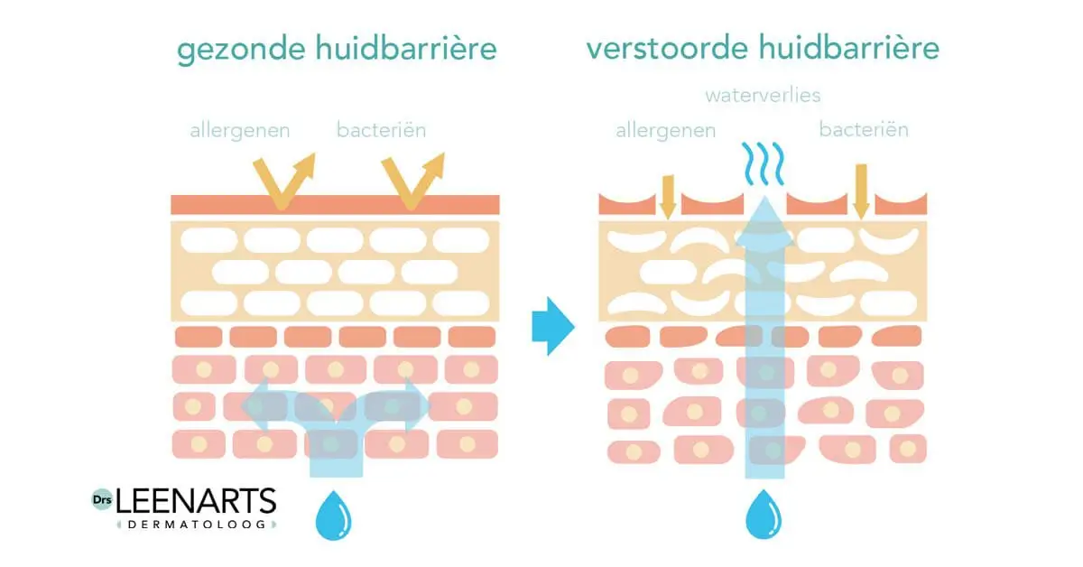 De gezonde en verstoorde huidbarriere uitgelegd door Drs Leenarts