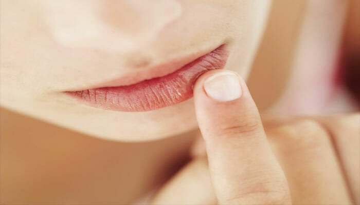 Lippen, koortslip en zon: bescherm je lippen in de zon!