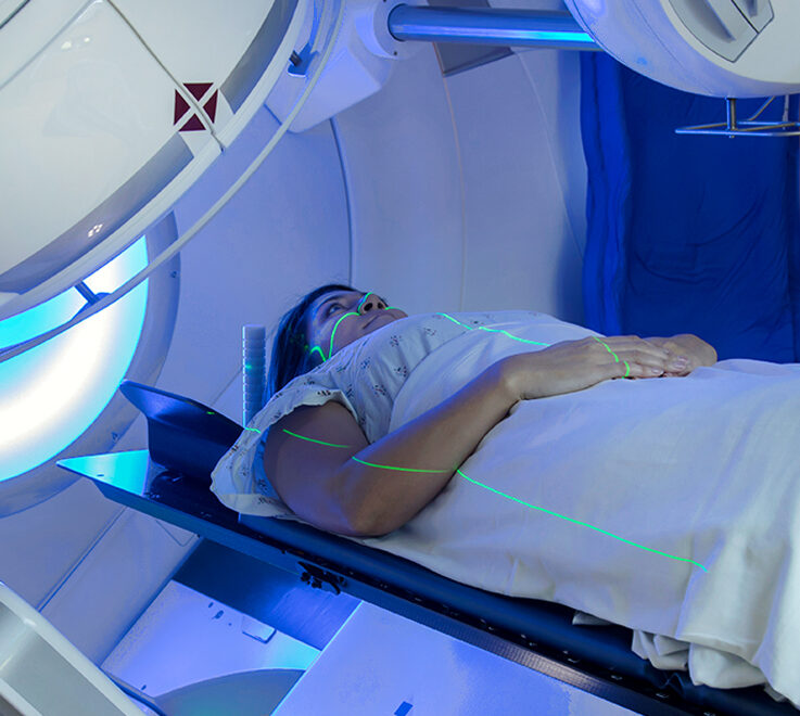 De huid na bestraling (radiotherapie) verzorgen