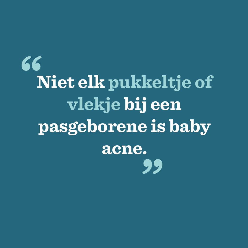Niet elk pukkeltje of vlekje bij een pasgeborene is baby acne.