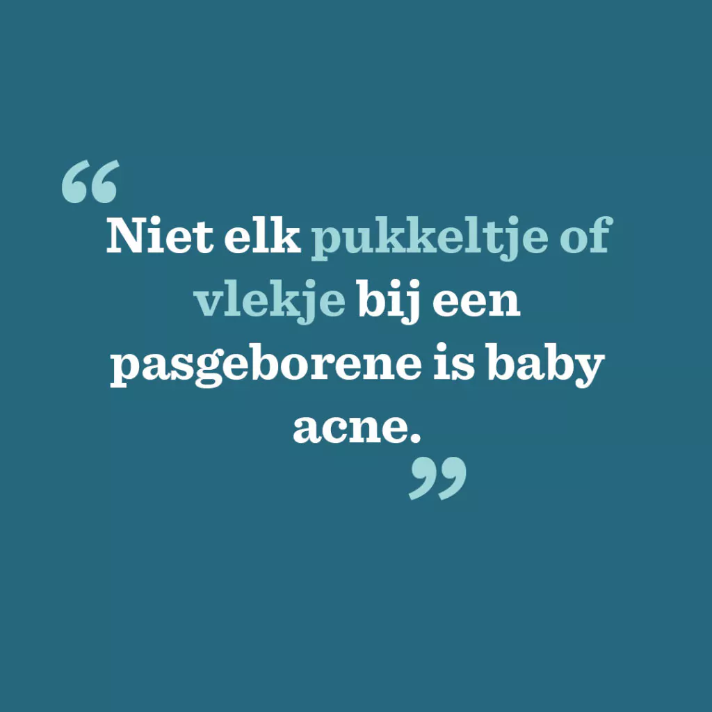 Niet elk pukkeltje of vlekje bij een pasgeborene is baby acne.